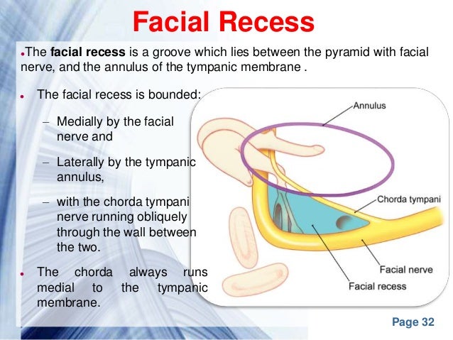 facial nerve recess Facial nerve recess